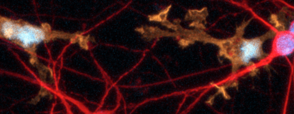 ioMicroglia 600px