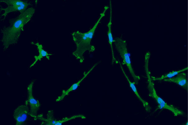 iPSC-derived Alzheimer's disease models show increased secretion of pathogenic amyloid beta peptides in glutamatergic neurons and responses to amyloid beta 42 in microglia