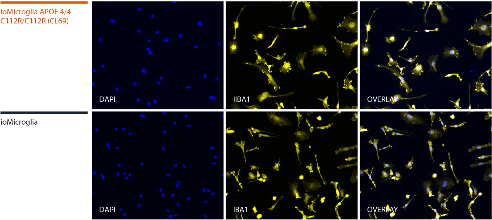 microglia apoe 4/4 iba1 ICC alzheimers disease model