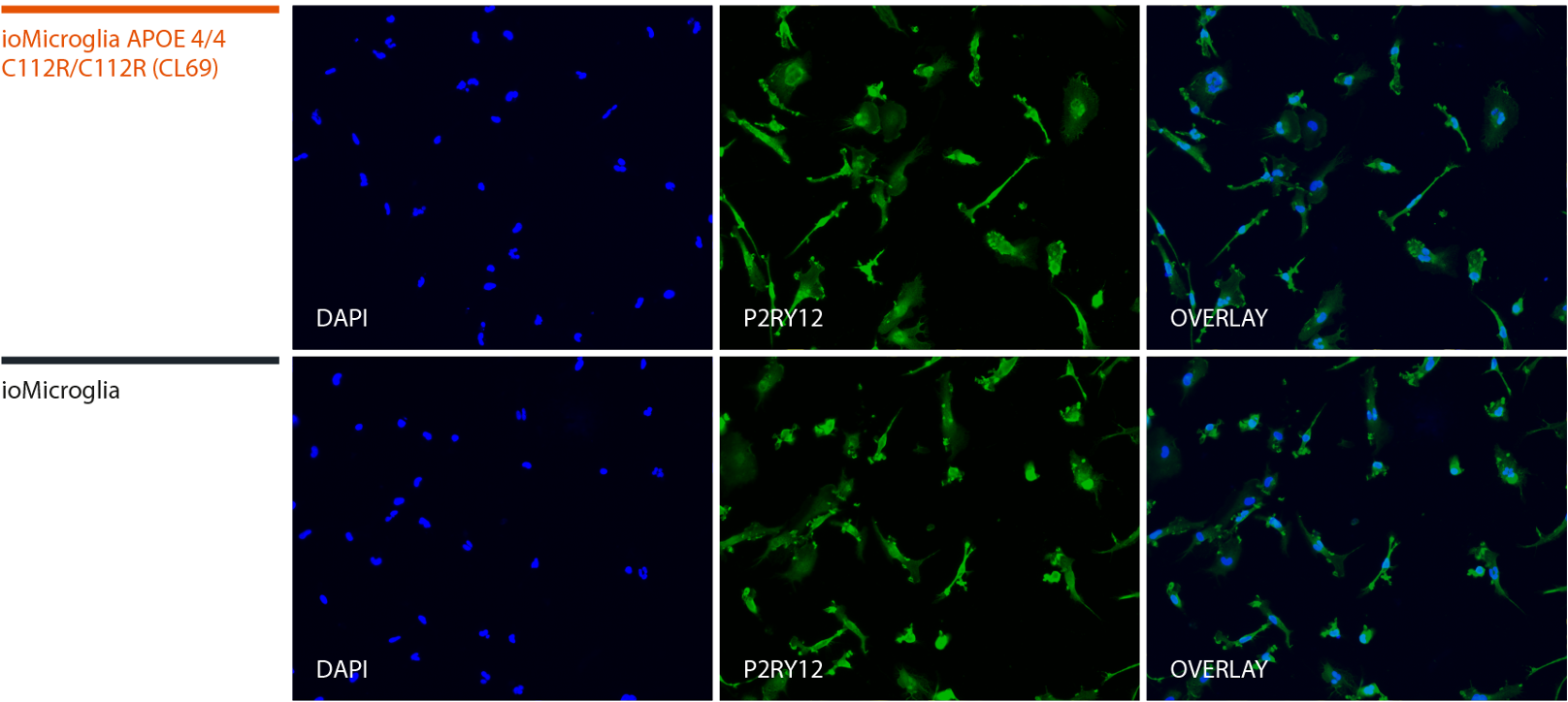 microglia apoe 4/4 pr2y12 ICC alzheimers disease model