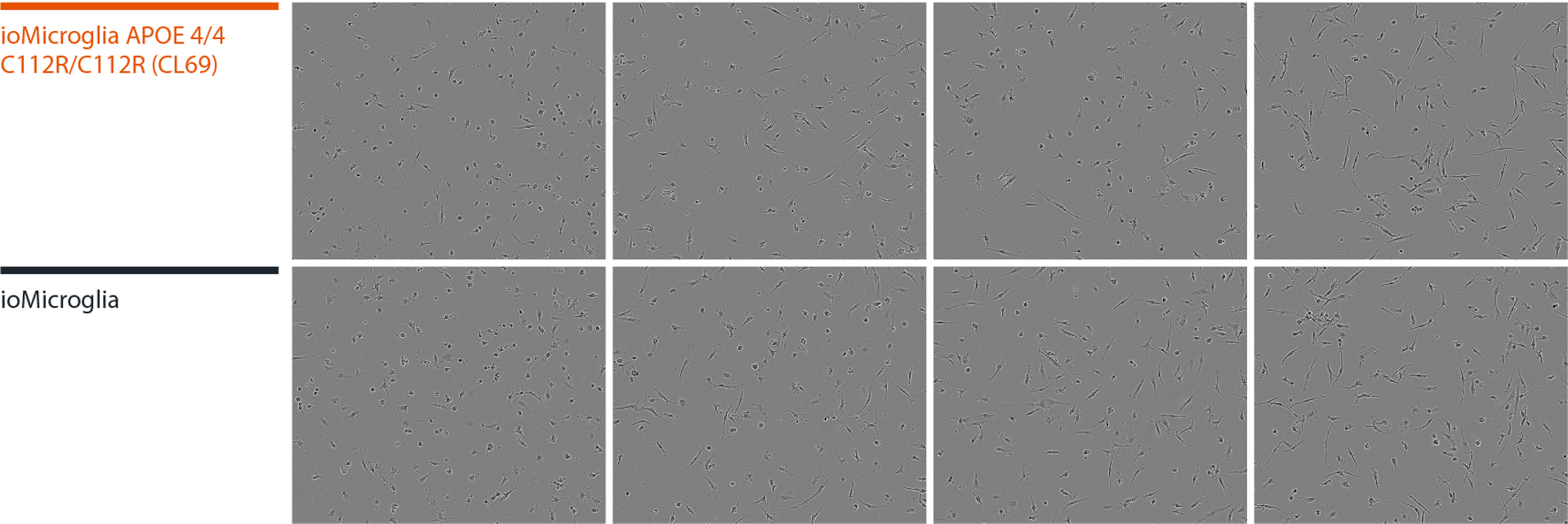 microglia apoe 44 morphology alzheimers disease model