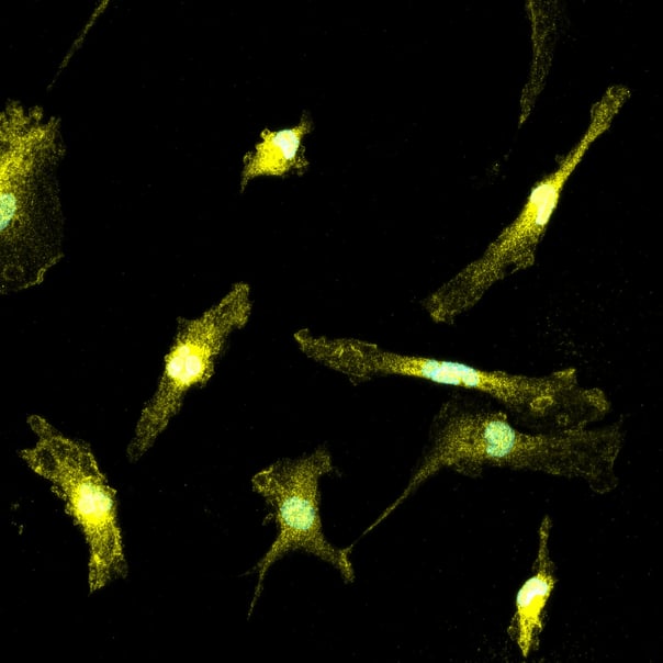 Functional genomics workshop Top tips for human iPSC-derived cells | bit.bio