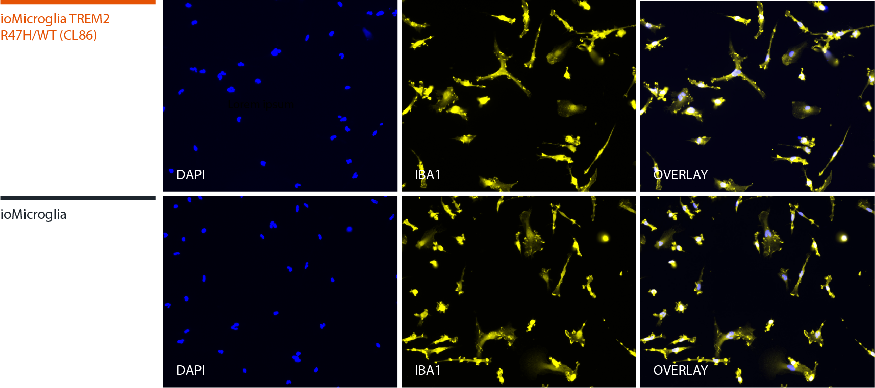 Immunofluorescent staining of human microglia with marker IBA1