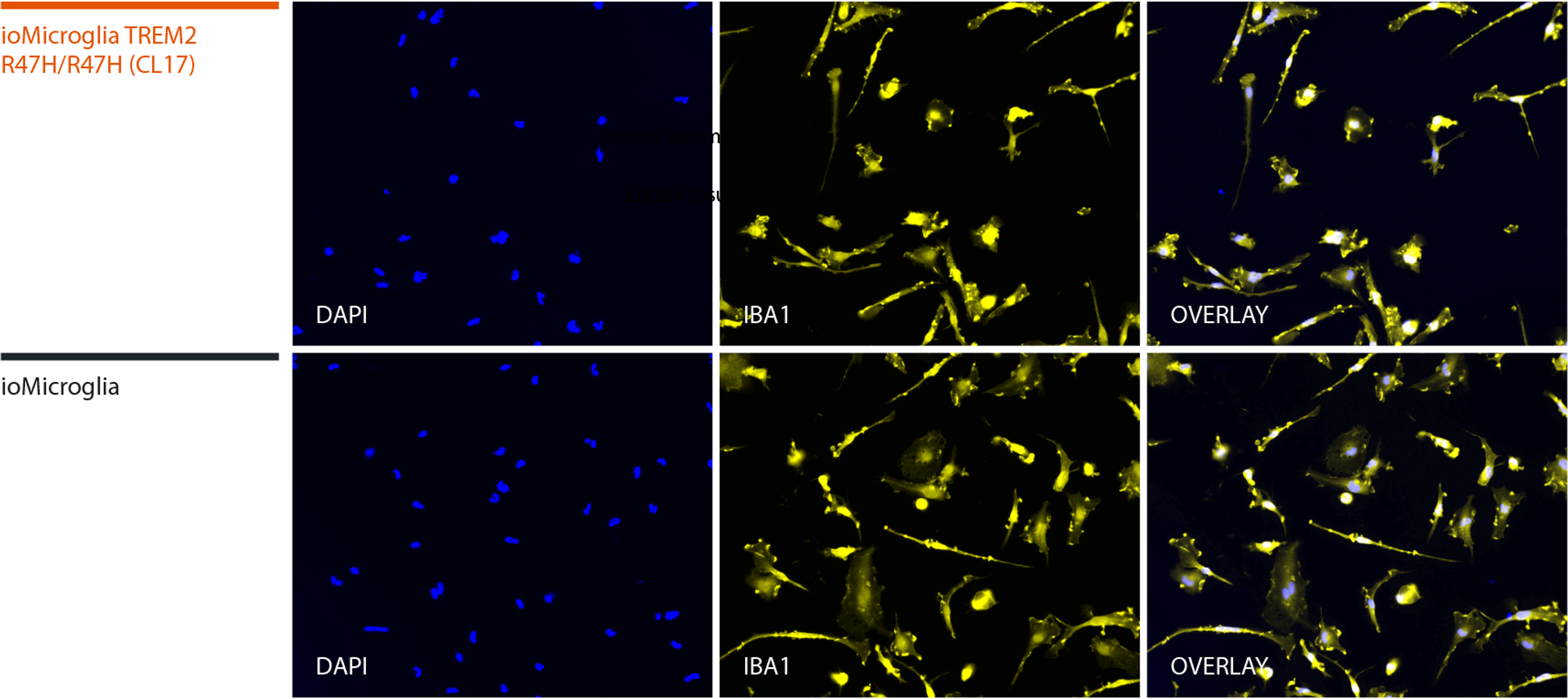 microglia-TREM2-hom-iba1-ICC