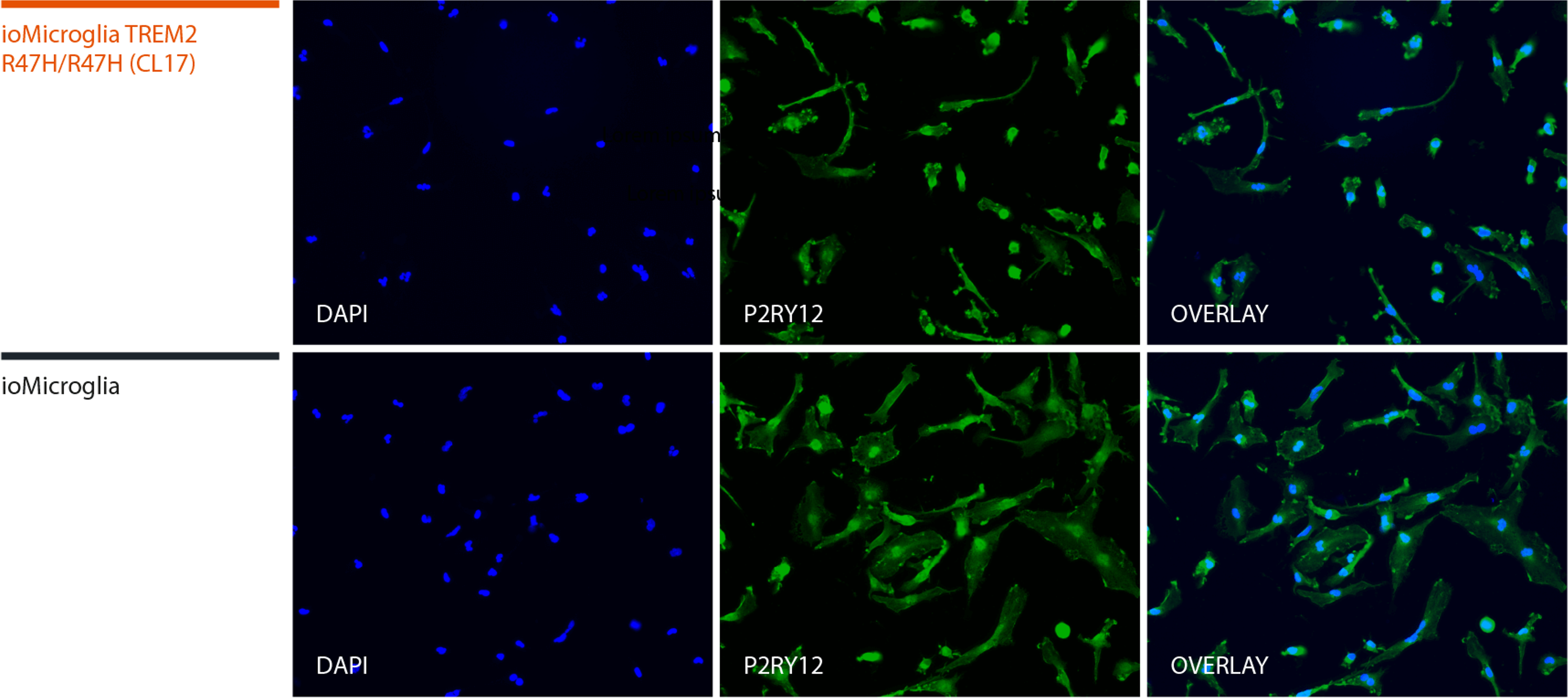 microglia-TREM2-hom-pr2y12-ICC