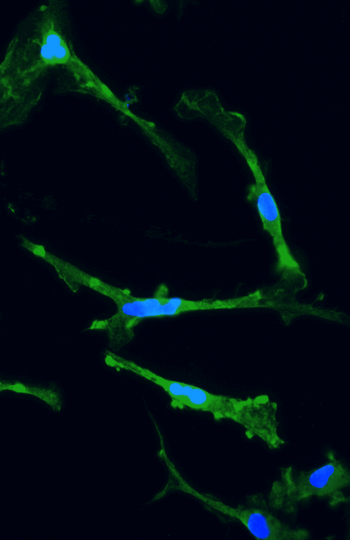 Tackling the reproducibility crisis with standardised human cells