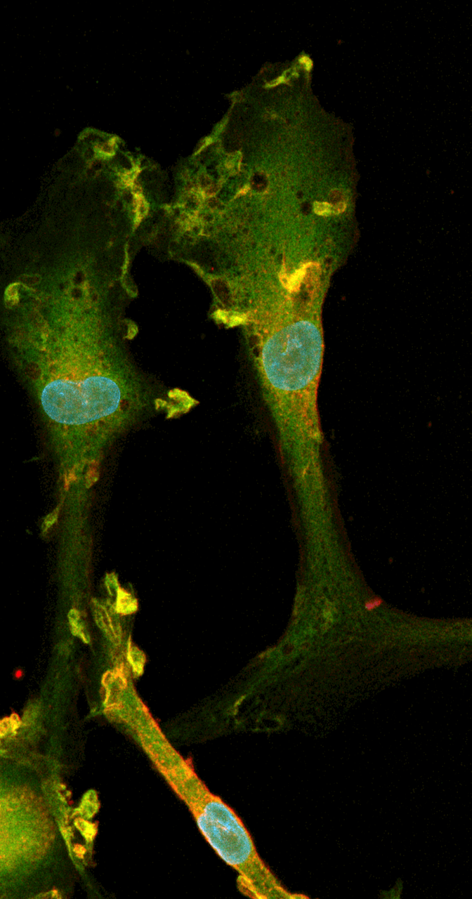 human ipsc derived Microglia IF IBA1