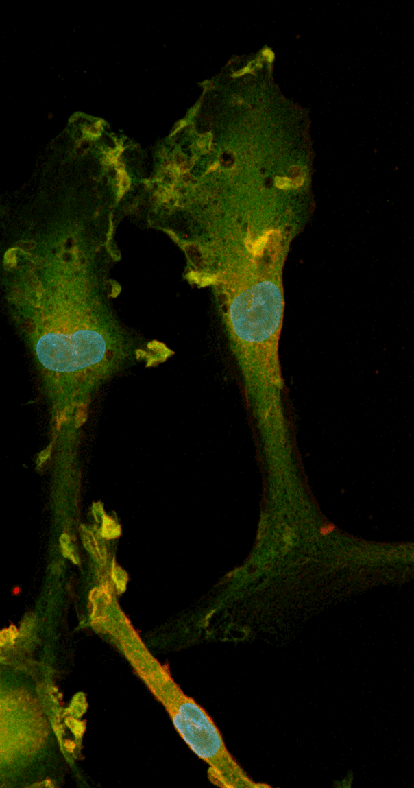 Cell detachment protocol for ioMicroglia