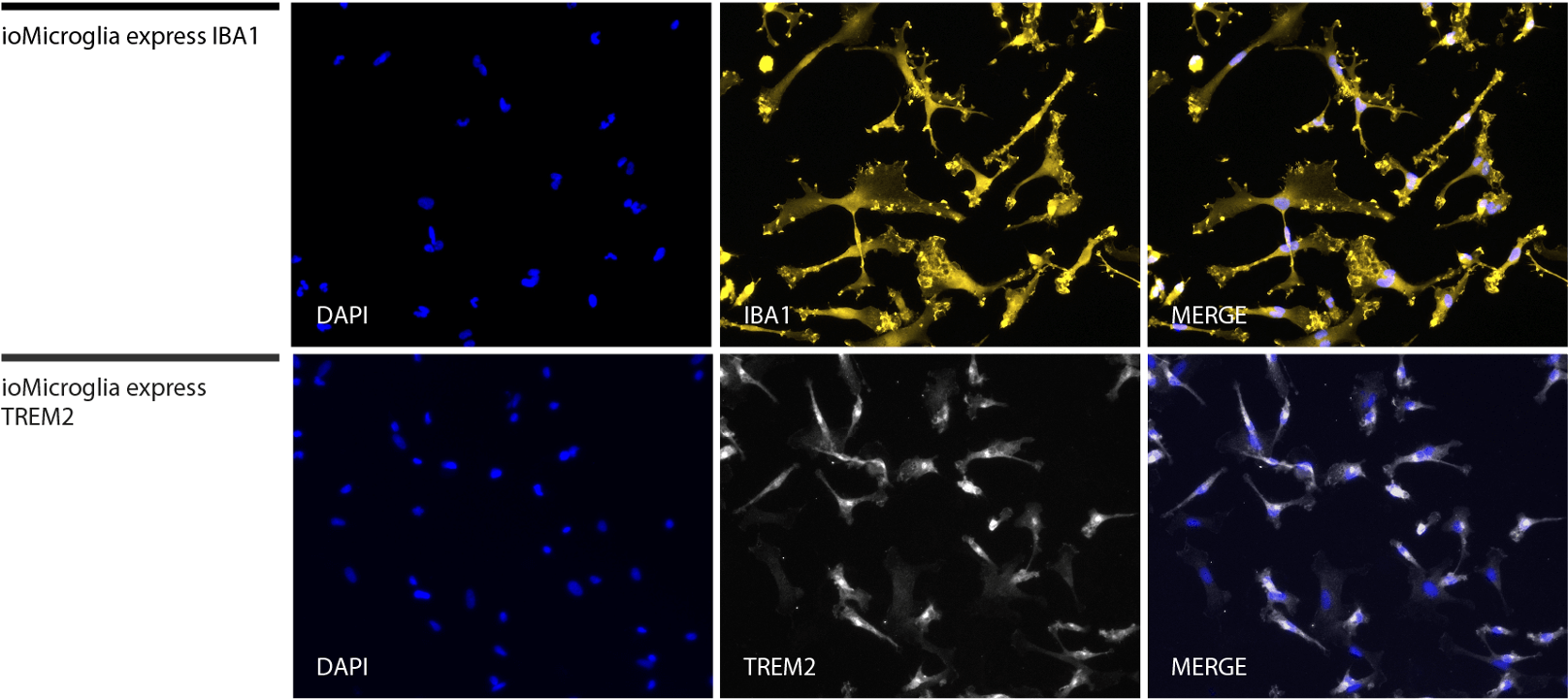 ioMicroglia female ICC trem2 iba1