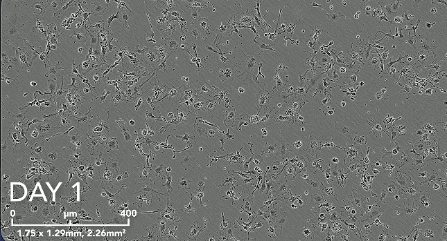 ioMicroglia morphology video thumb