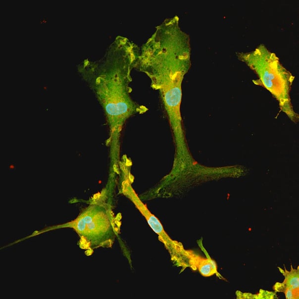 A human 3D neuroinflammation model using BrainZell organoids with integrated bit.bio ioMicroglia