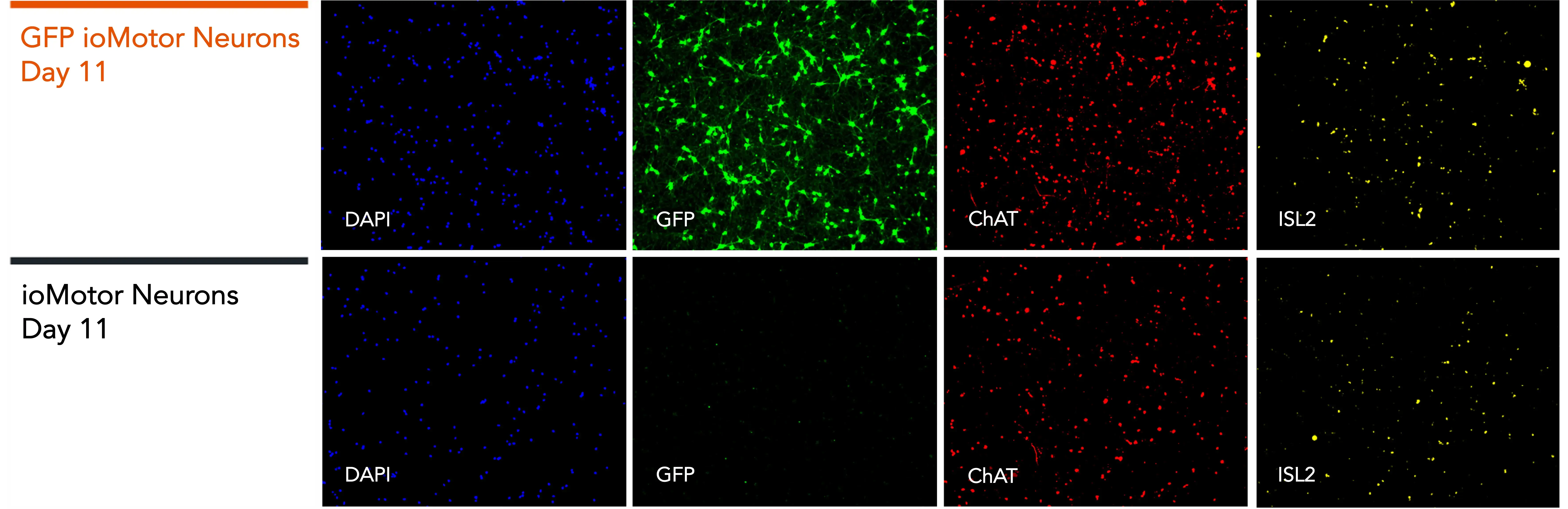 bit.bio_GFP_ioMotorNeurons_IF_Panel_D11_DAPI_GFP_CHAT_ISL2-1
