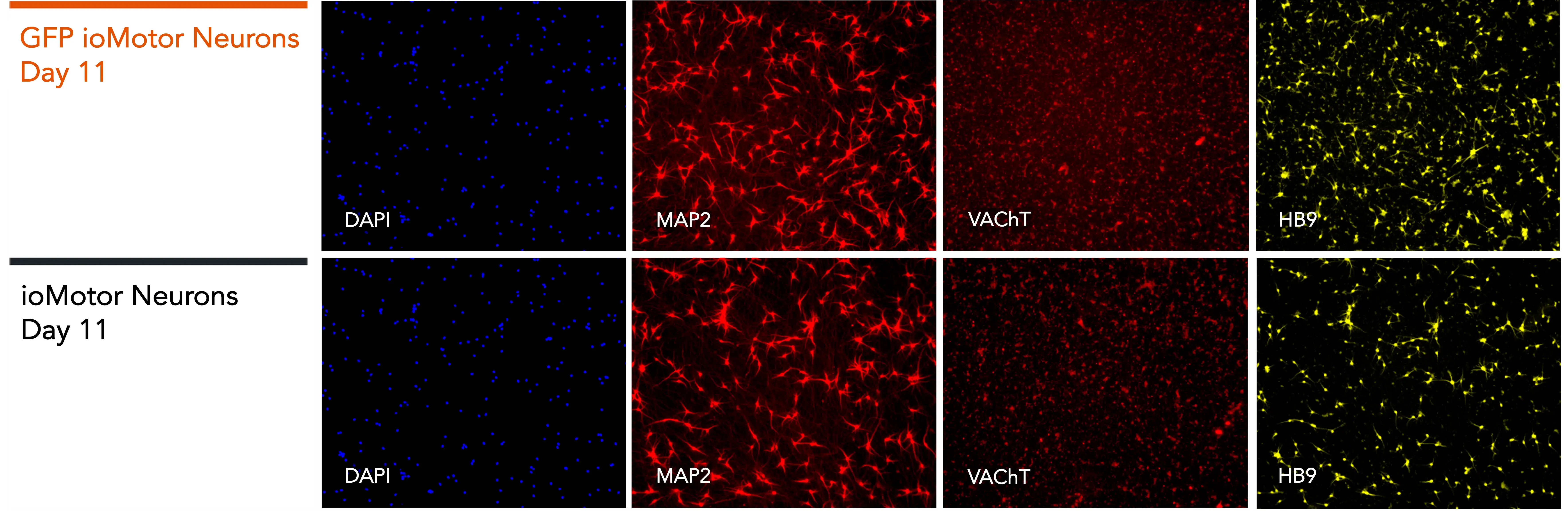 bit.bio_GFP_ioMotorNeurons_IF_Panel_D11_DAPI_MAP2_VACHT_HB9-1