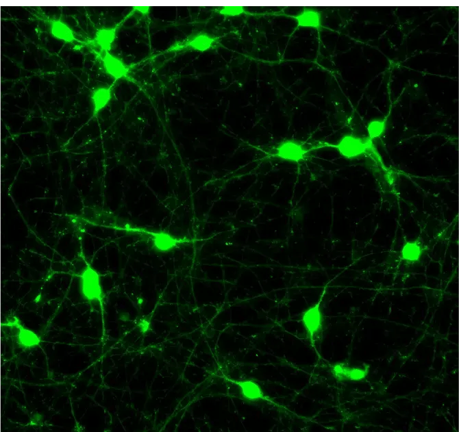 NEW! GFP ioMotor Neurons