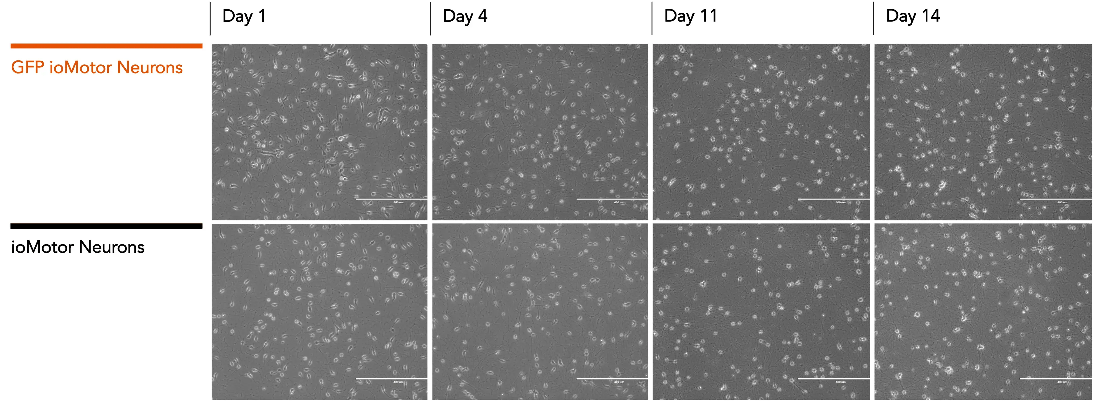 bit.bio_GFP_ioMotorNeurons_vs_WT_Brightfield_D1_D4_D11_D14