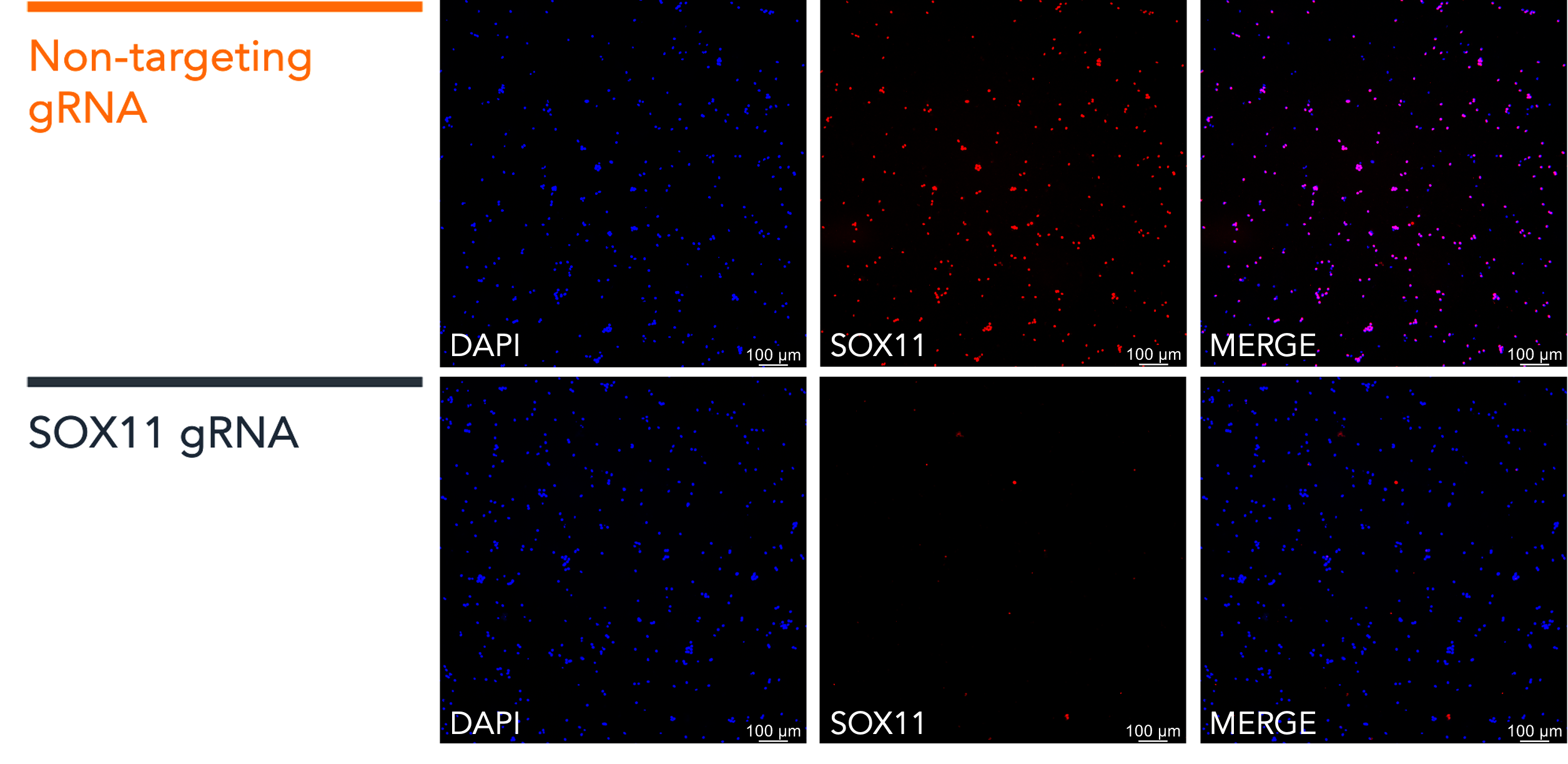 SOX11 functionality by immunofluorescence in CRISPR knockout ready ioMotor Neurons