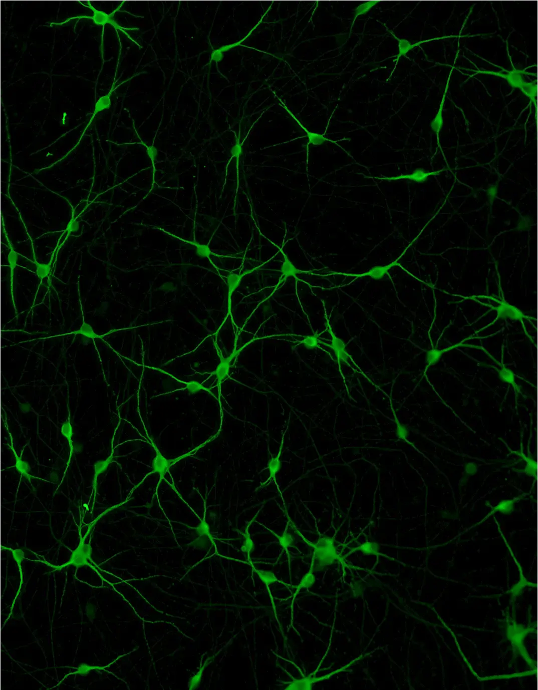 ioMotor Neurons SOD-1 G93A/WT
