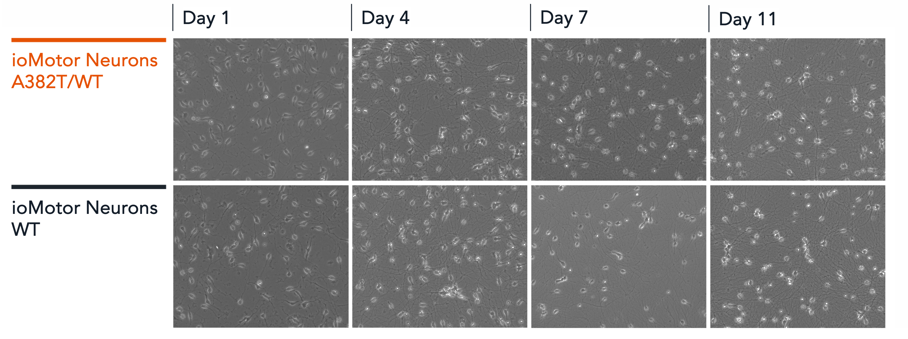 ioMotorNeurons_TDP-43_A382T_Brightfield_morphology
