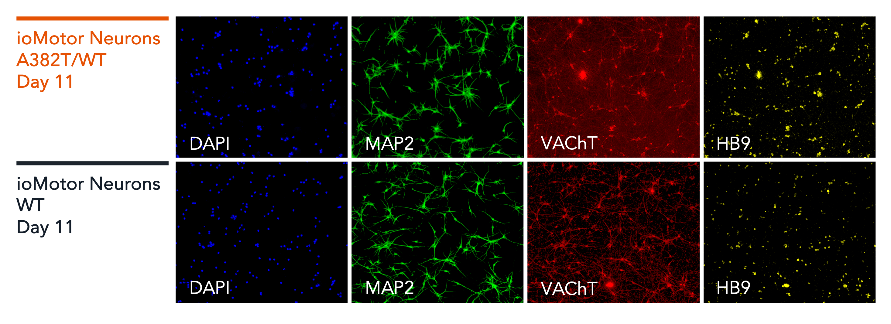 ioMotorNeurons_TDP-43_A382T_Immunocytochemistry_Panel2