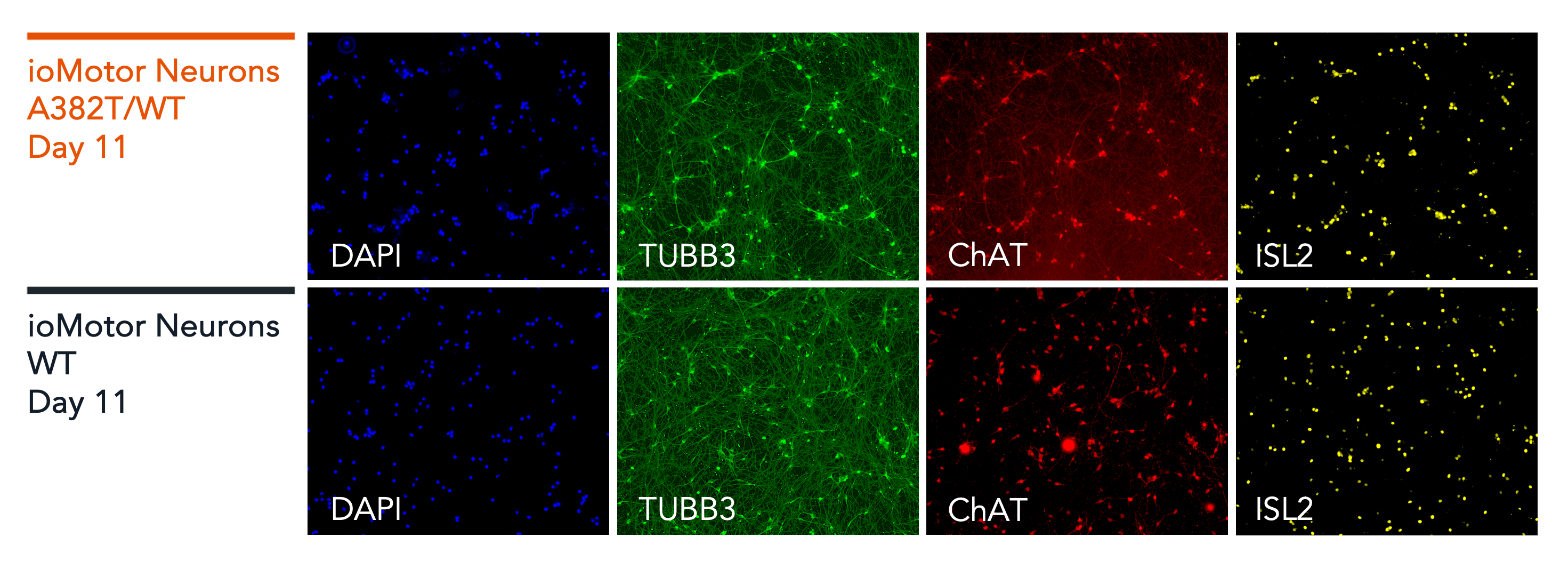 ioMotorNeurons_TDP-43_A382T_mmunocytochemistry_Panel1