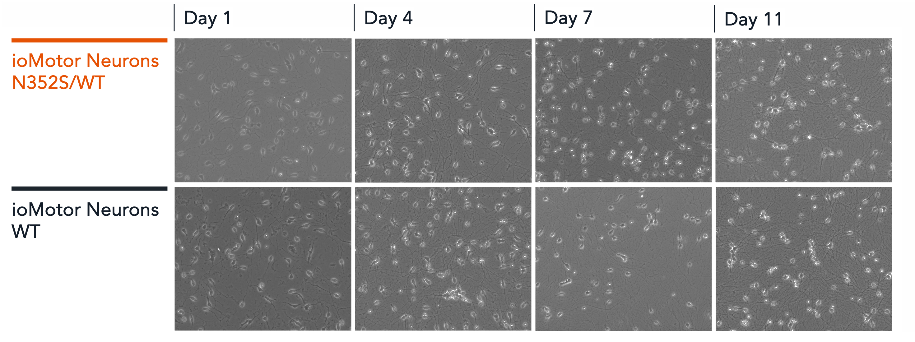 ioMotorNeurons_TDP-43_N352S_Brightfield_Morphology