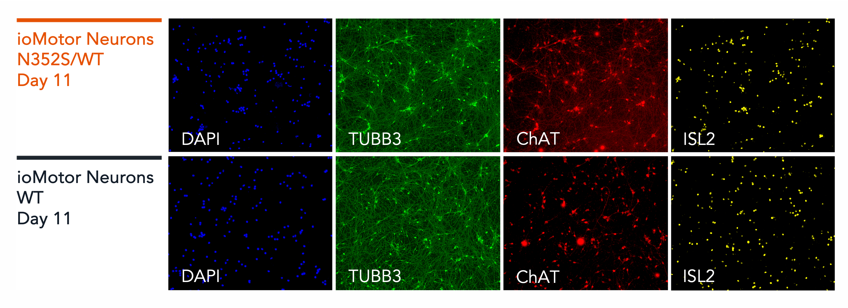 ioMotorNeurons_TDP-43_N352S_Immunocytochemistry_Panel1