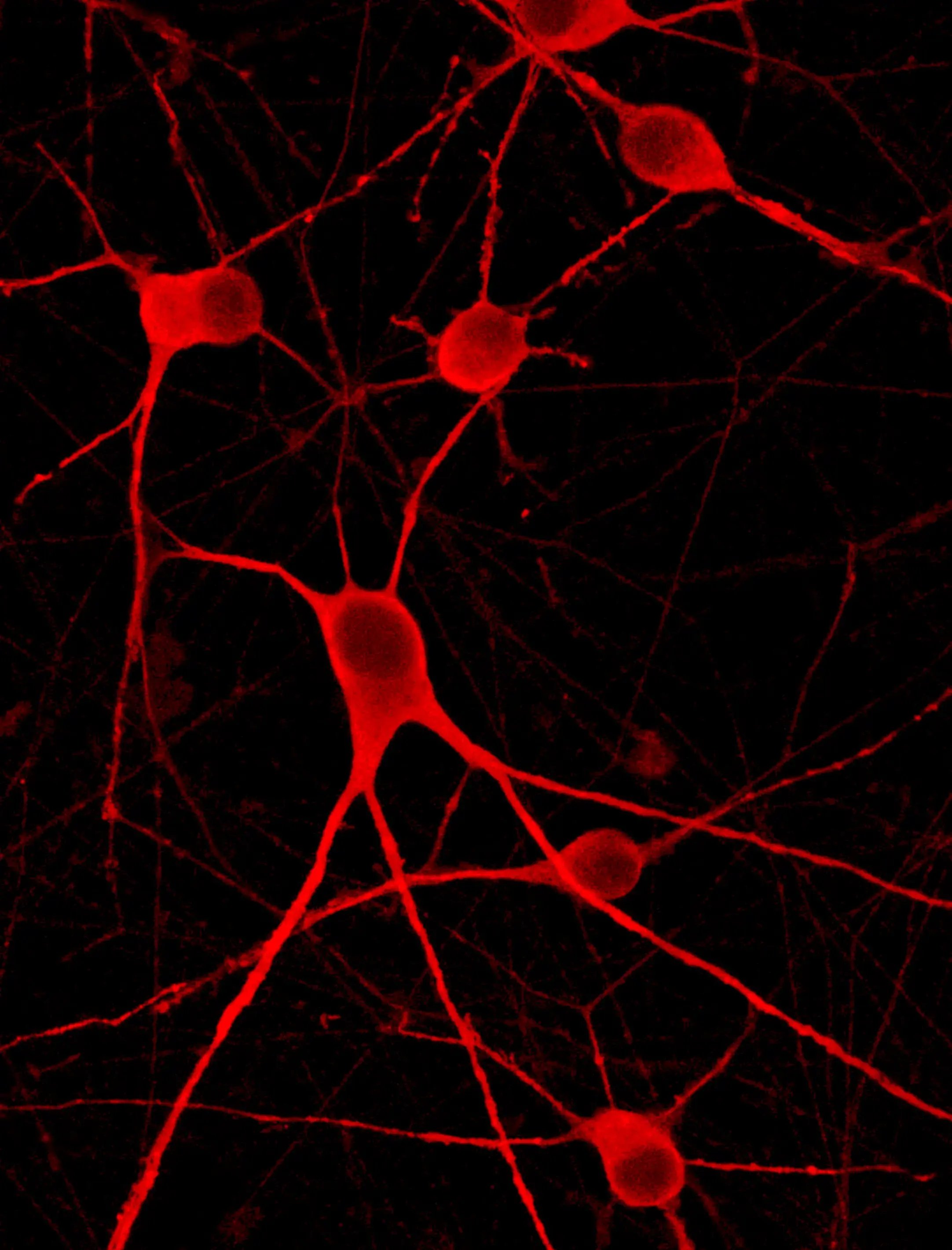 ioMotor Neurons