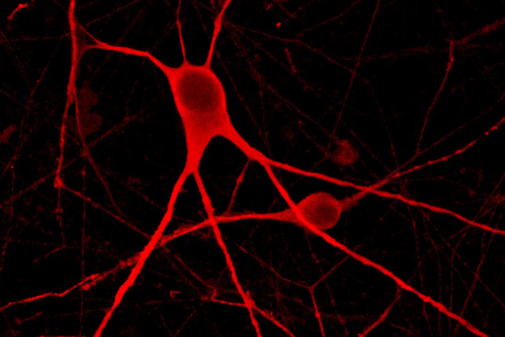 iomotor_neuron_HERO_ICC