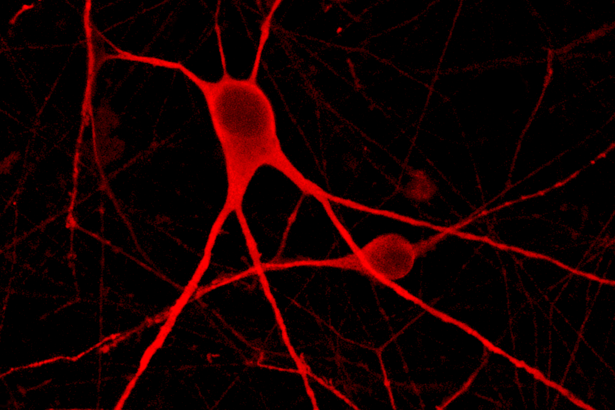 Immunocytochemistry staining of human iPSC-derived motor neurons to identify, characterise, and validate in vitro.