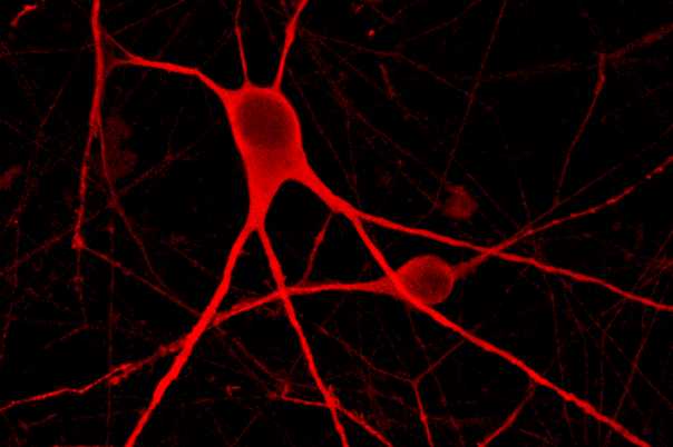 UPCOMING! Immunocytochemistry workshop  Top tips for human iPSC-derived cells