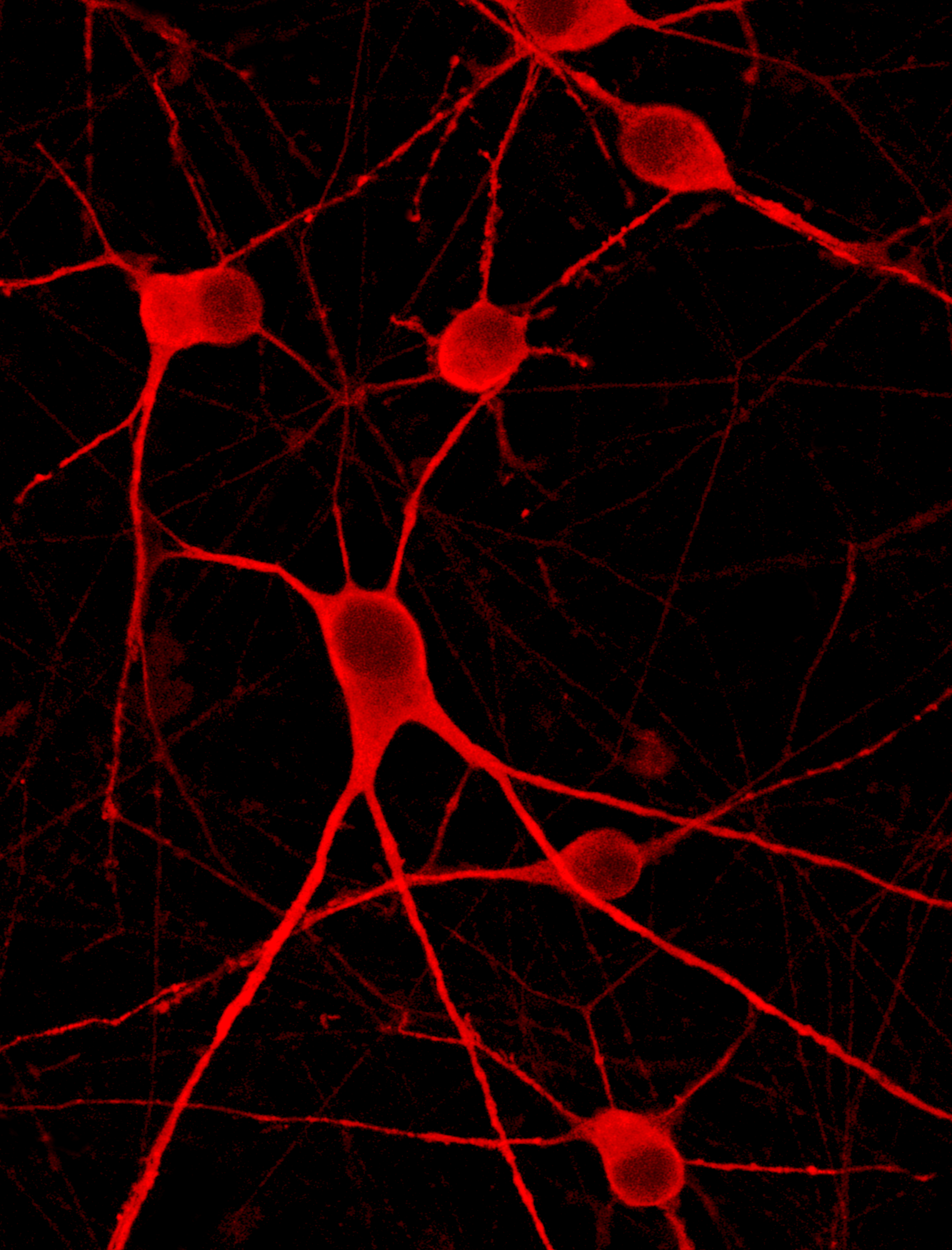 Immunofluorescence staining of ioMotor Neurons; human induced pluripotent stem cell-derived motor neurons.