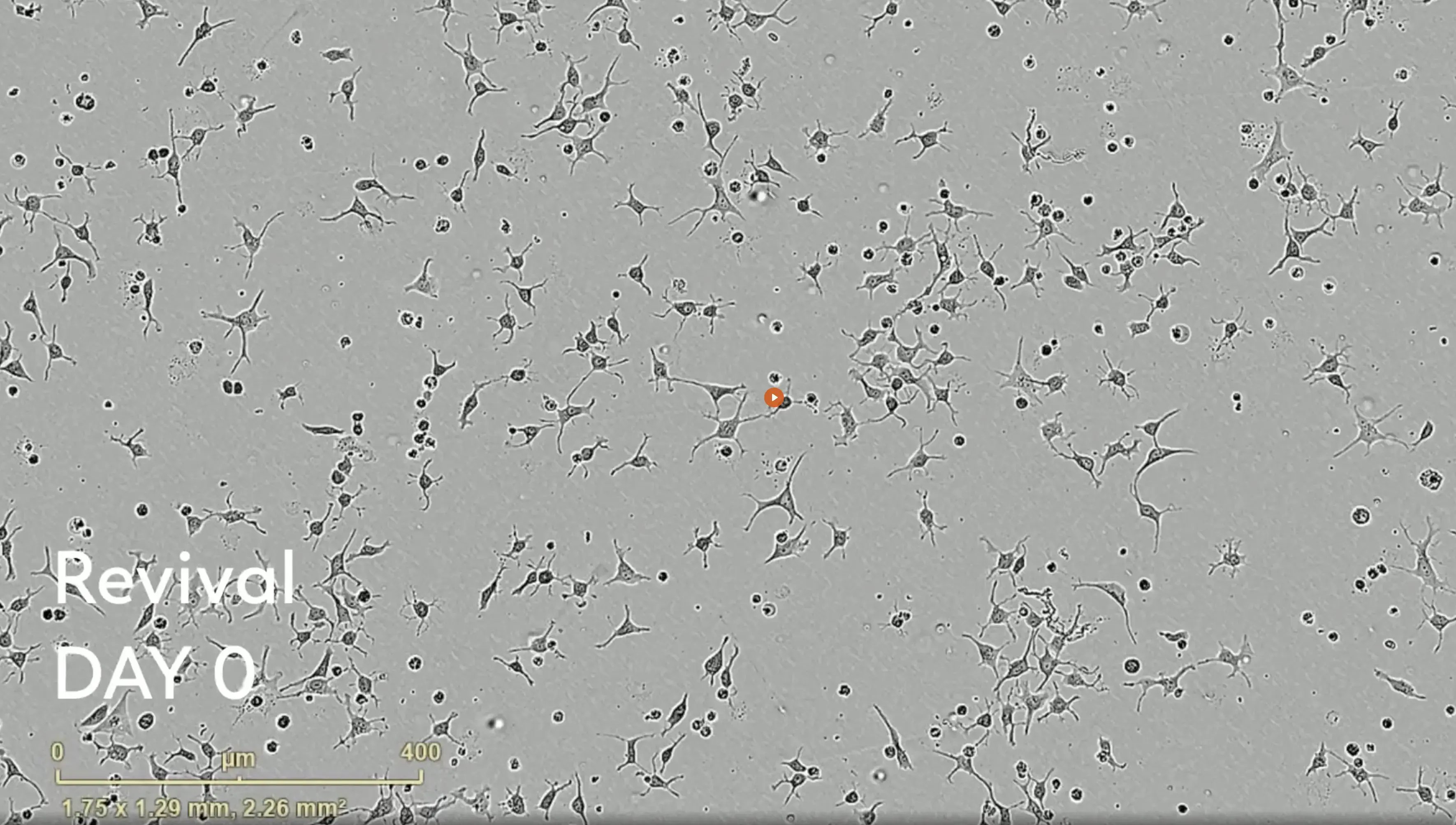 Human ioOPC-like cells morphology image upon revival on day 0