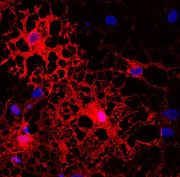 ioOligodendrocyte-like cells