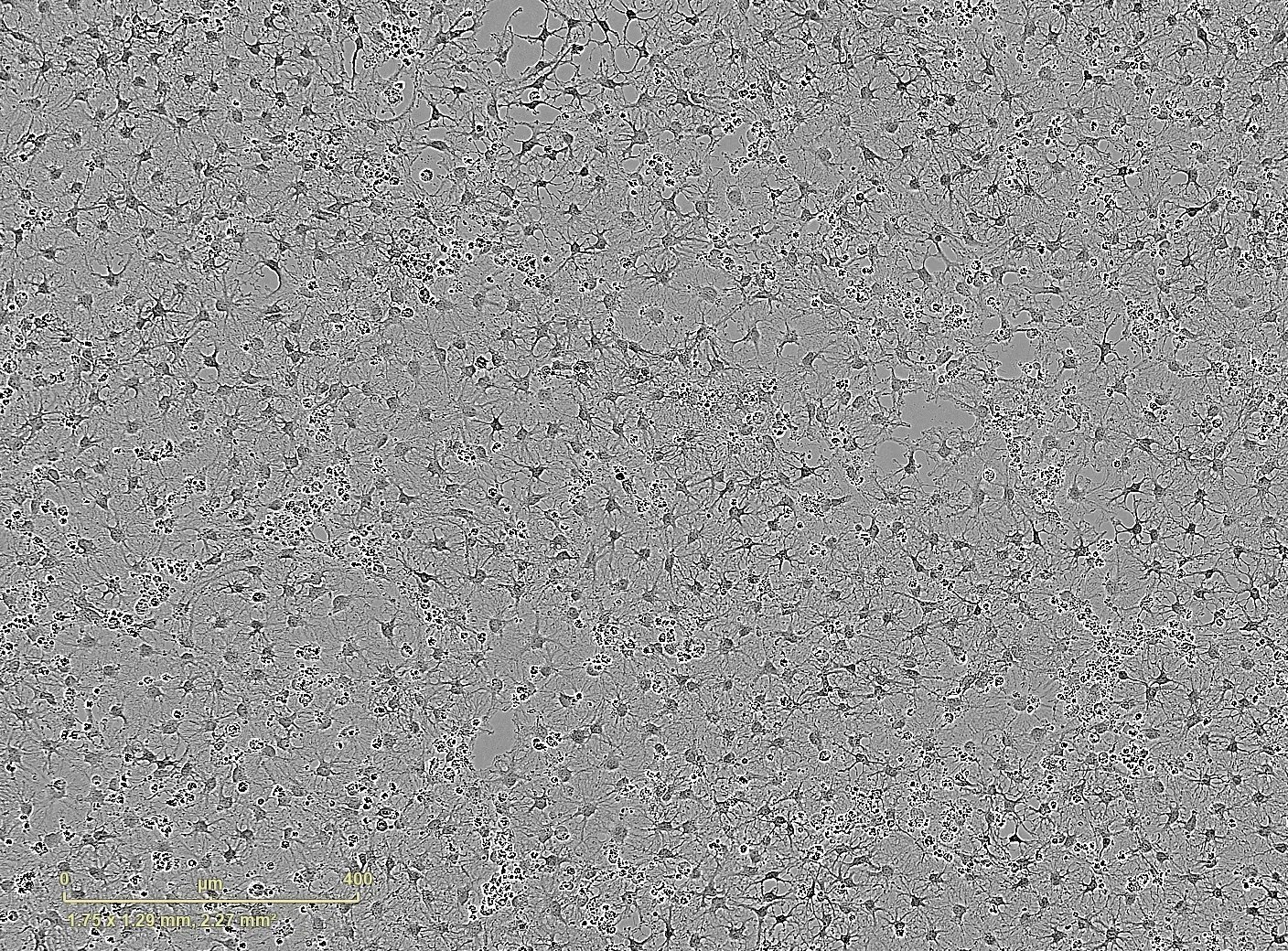 Time-lapse video capturing the rapid and homogeneous acquisition of an OPC-like morphology and maturation towards an oligodendrocyte-like morphology