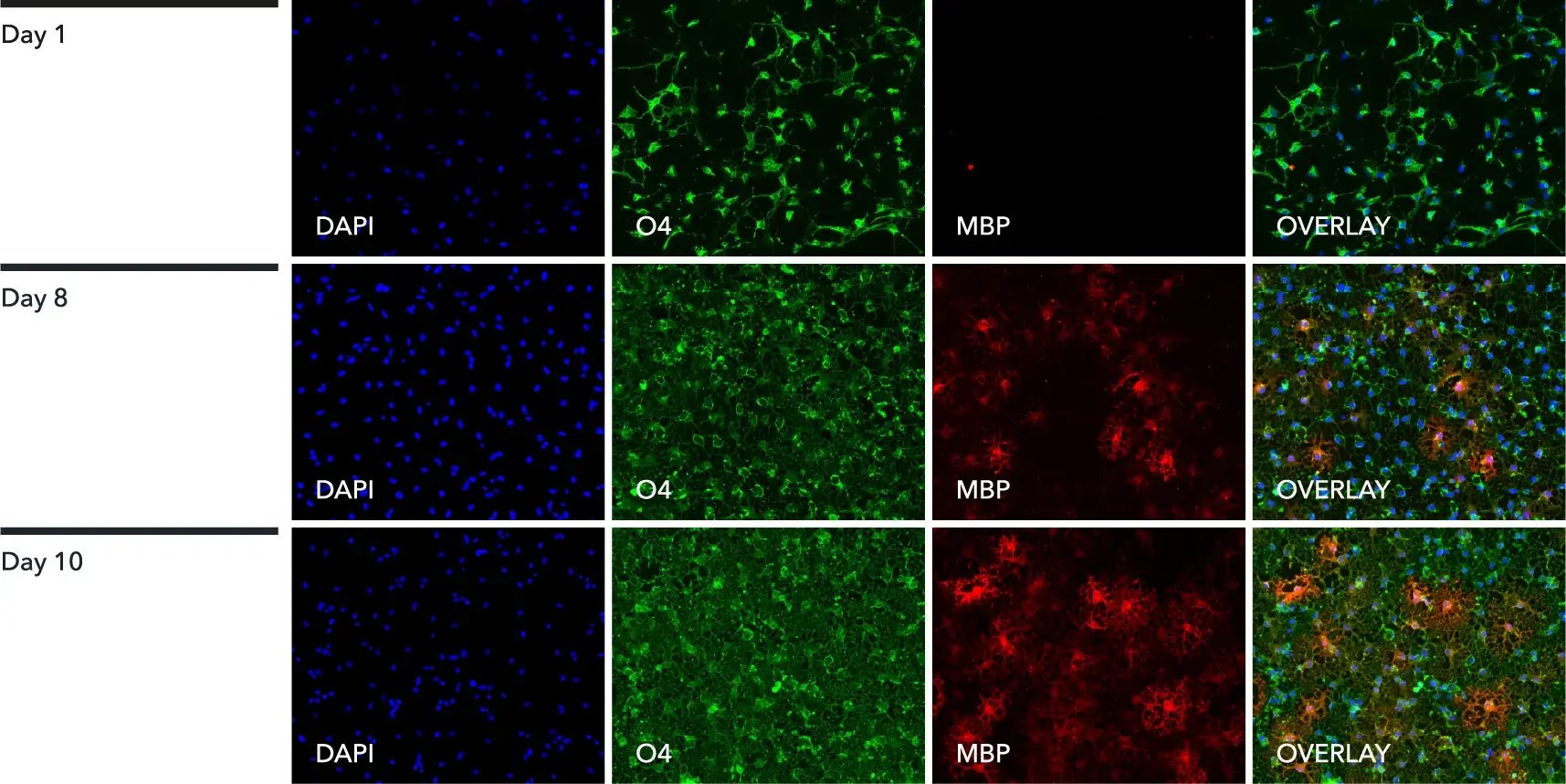 Immunostaining panel for ioOligodendrocyte-like cells with DAPI, O4 and MBP.