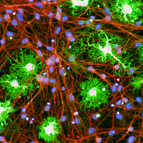 ioOligodendrocyte-like cells in co-culture with ioGlutamatergic Neurons