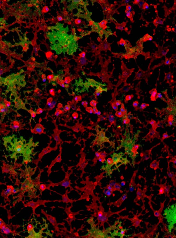 Human iPSC-Based Models of Glial Cells for Studying Neurodegenerative Disease