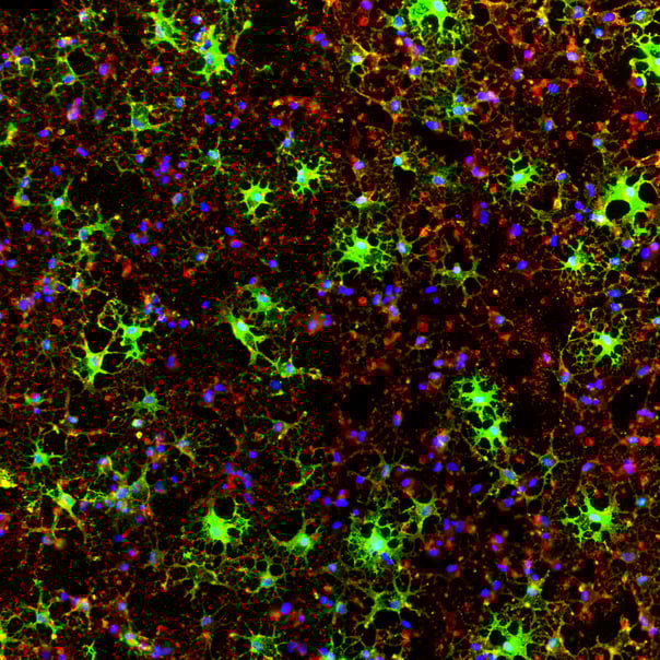 Enhancement of MBP expression in human iPSC-derived oligodendrocyte-like cells by optimising db-cAMP concentration in media