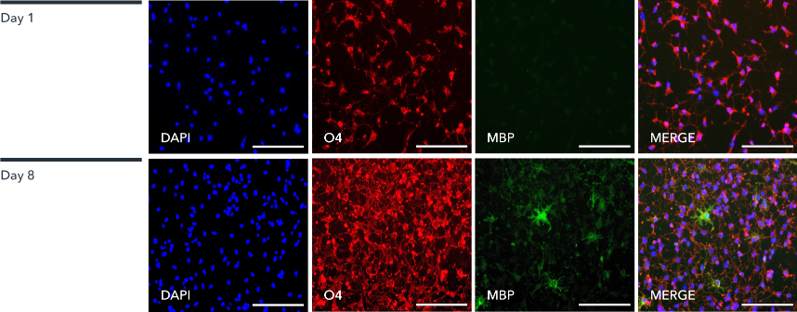 bitbio-oligodendrocyte-like-cells-immunocytochemistry-staining-for-key-oligodendrocyte-marker-MBP