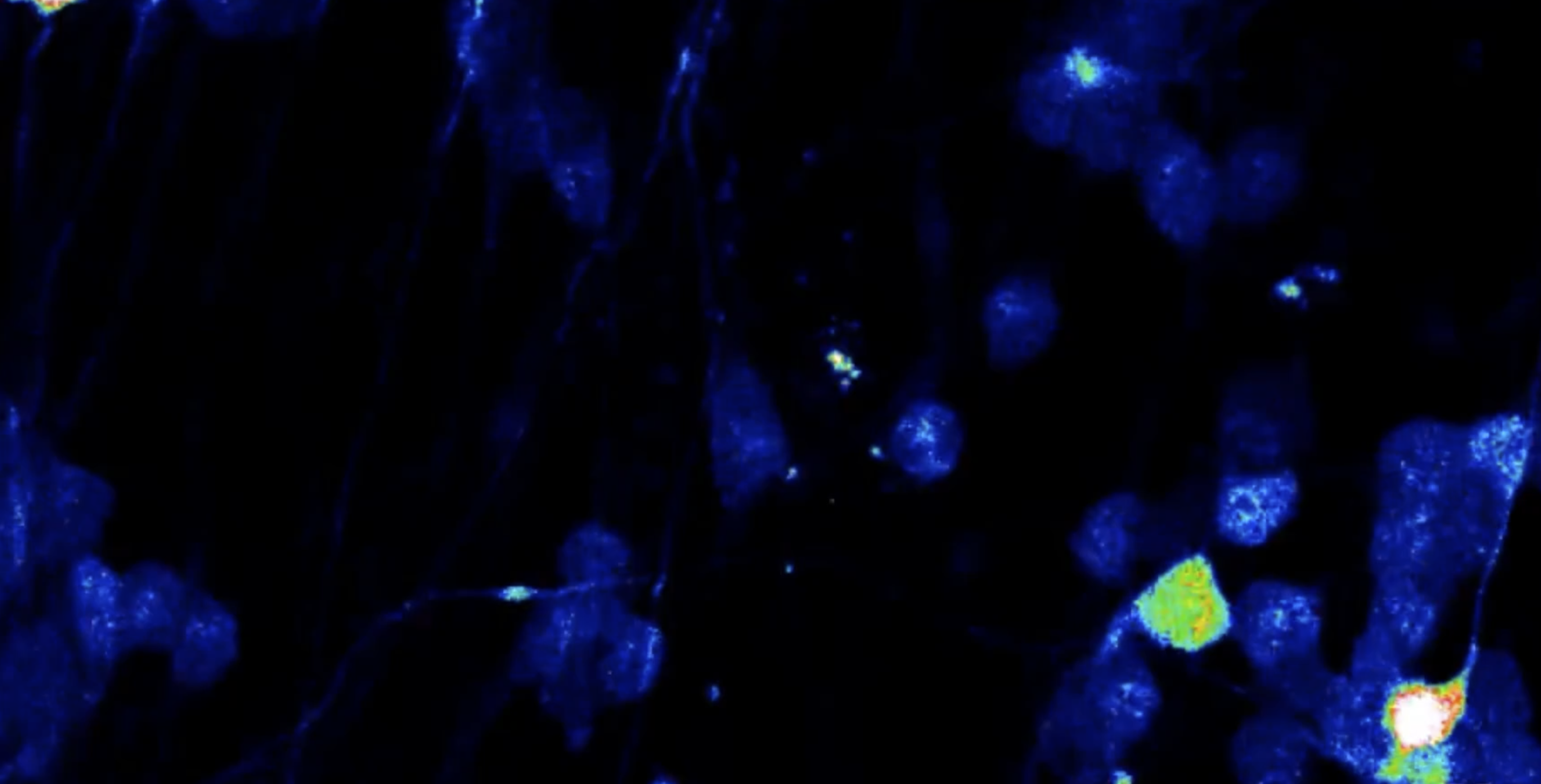 Representative video of human iPSC-derived Sensory Neurons displaying calcium mobilisation in response to treatment with the TRPM3 agonist, CIM0216