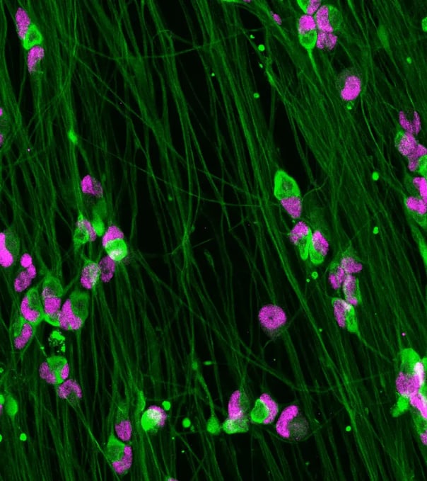 Lentiviral transduction of ioSensory Neurons | bit.bio