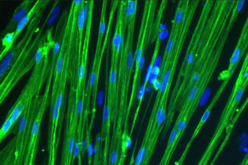 ioSkeletal Myocytes DMD Exon 52 Deletion™