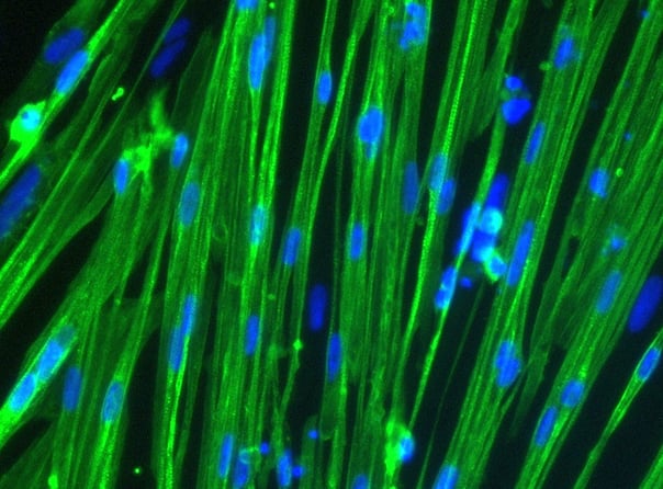 Advancements in 3D modeling: Building mature, functional 3D skeletal muscle microtissues in vitro