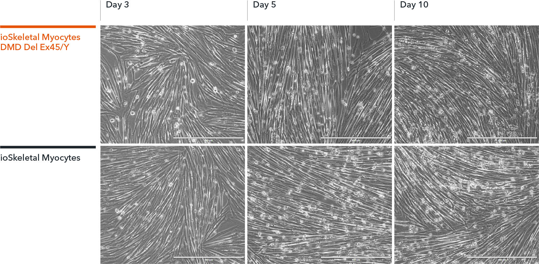 bit.bio-io6021-skeletal-myocytes-dmd-exon45-deletion-morphology