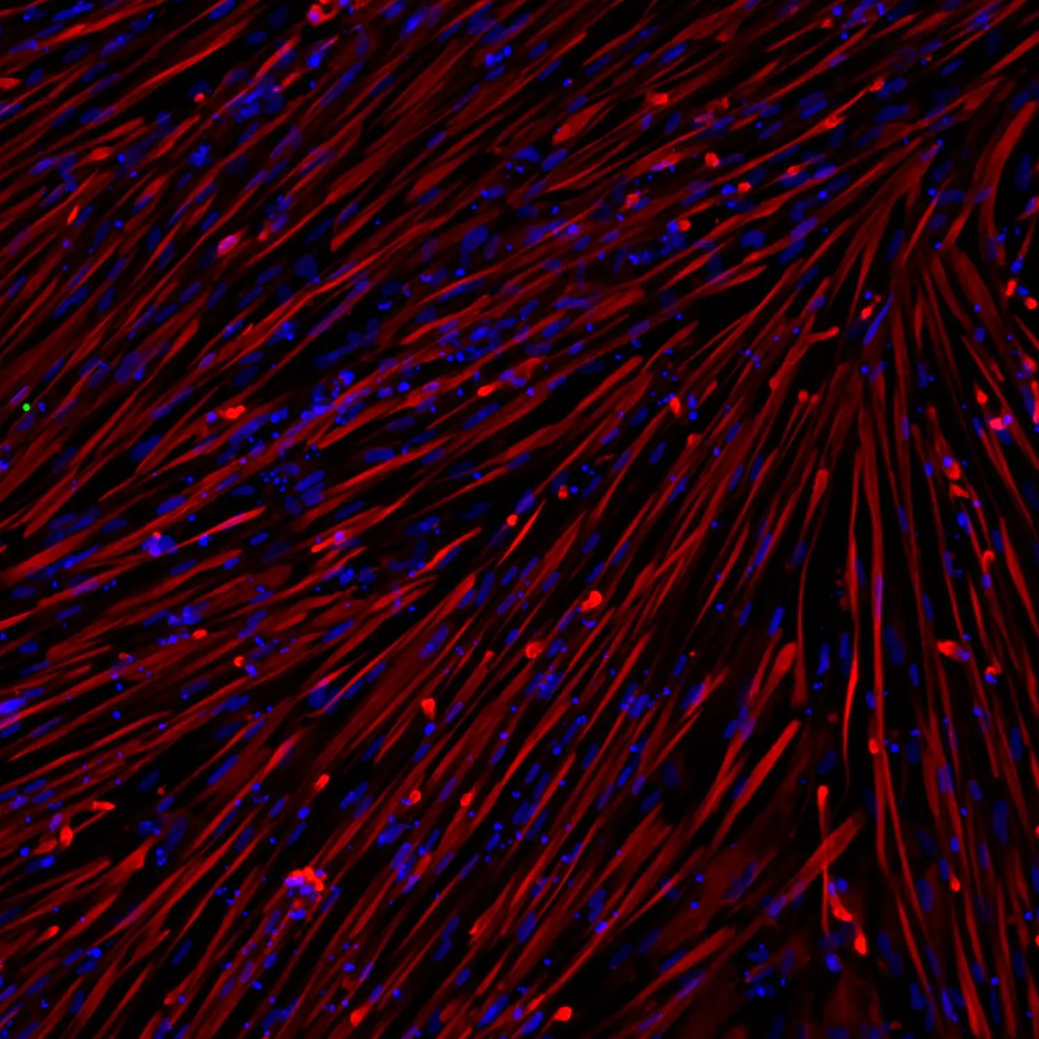 ioSkeletal Myocytes DMD Exon 45 Deletion