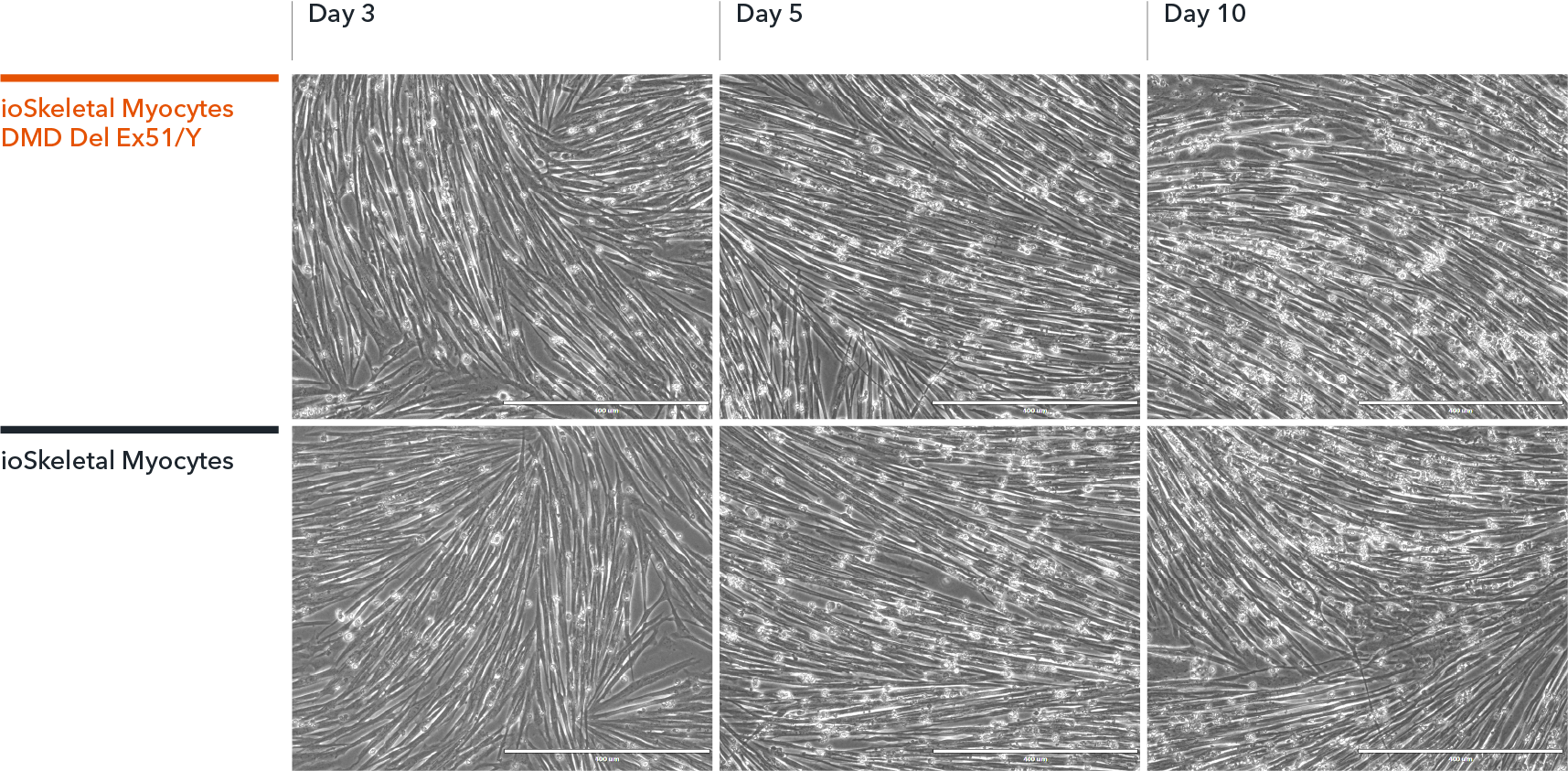 bit.bio iPSC-derived skeletal myocytes DMD exon 51 deletion show classical myocyte morphology