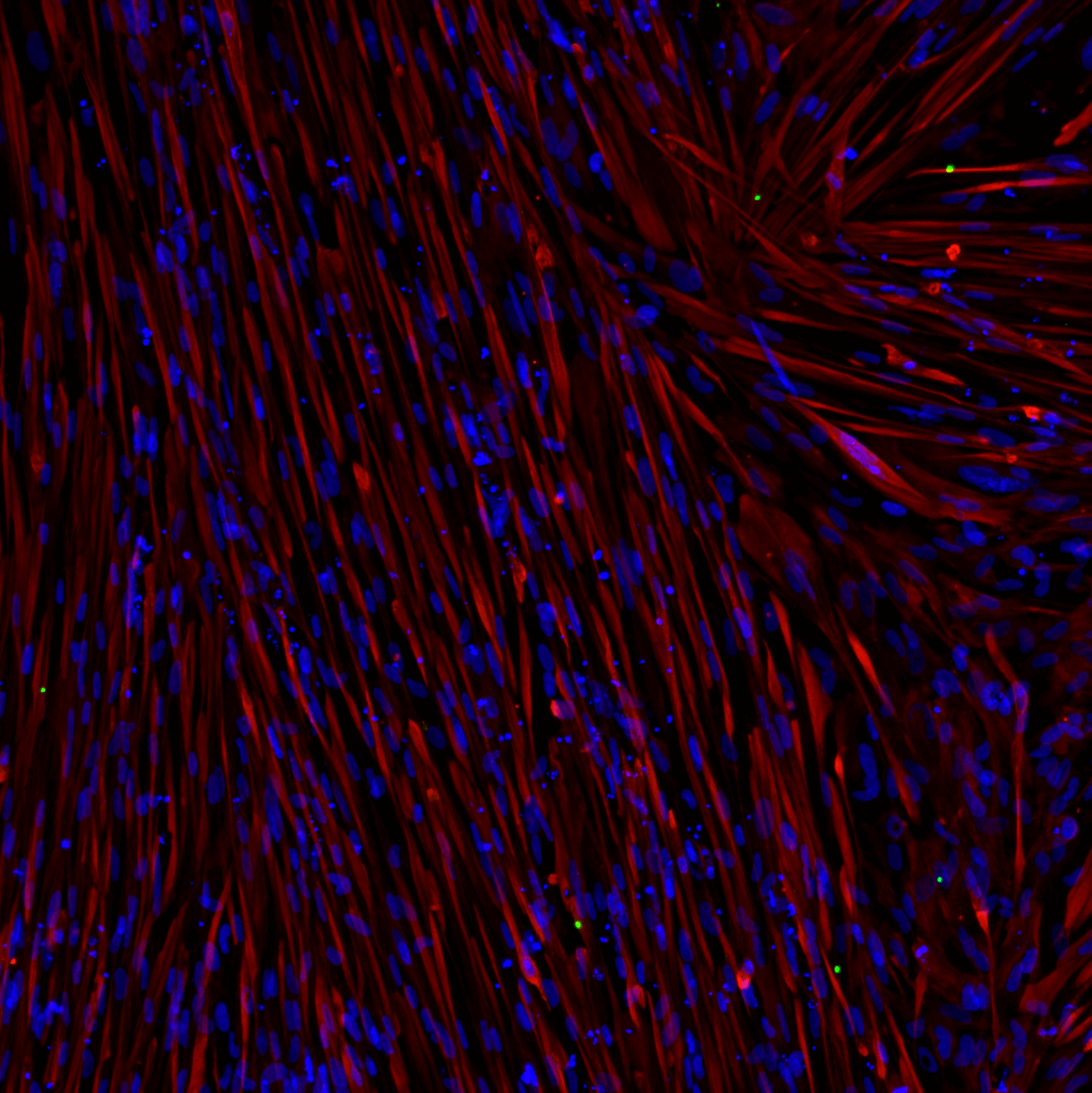 New! ioSkeletal Myocytes DMD Exon 51 Deletion