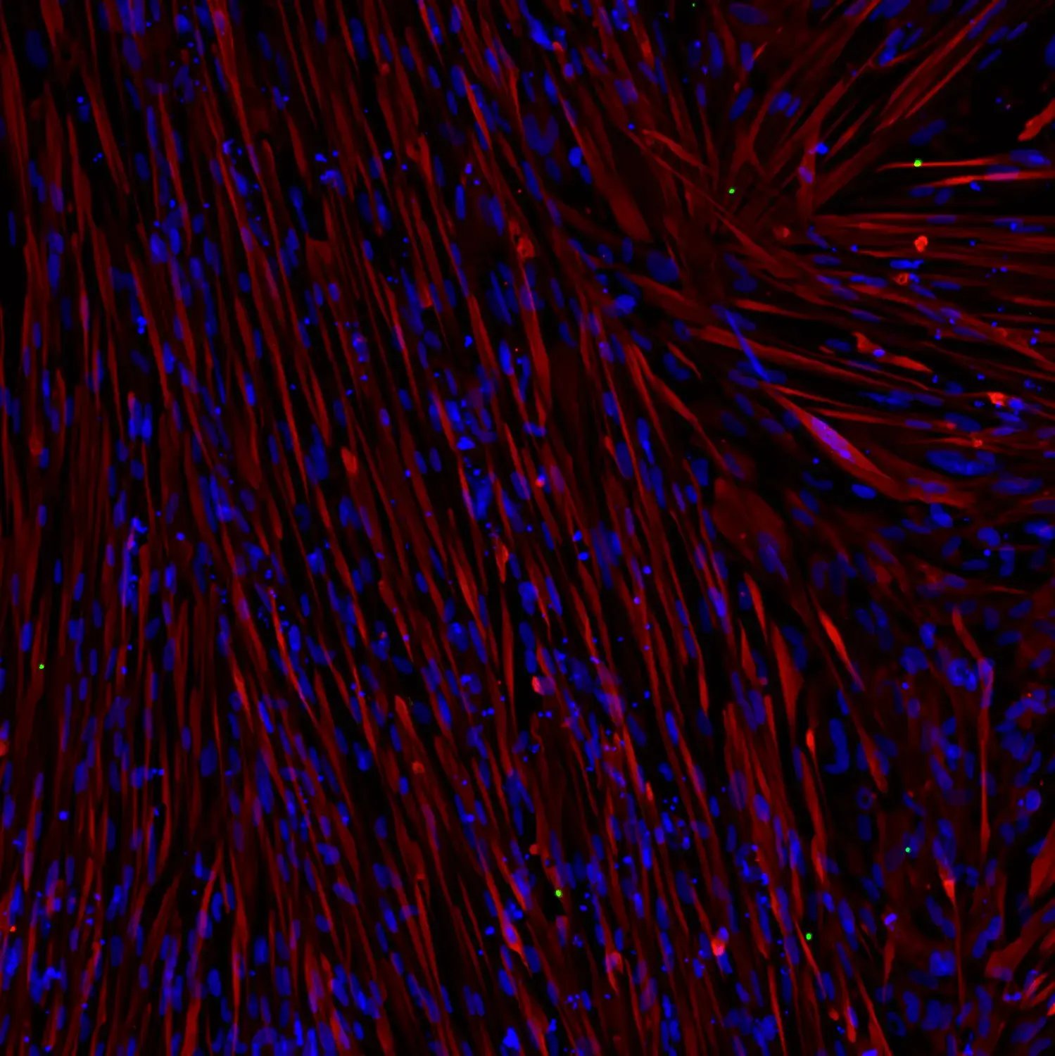 ioSkeletal Myocytes DMD Exon 51 Deletion