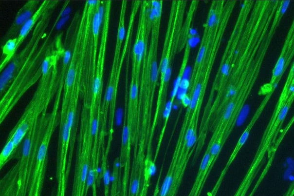 mRNA transfection of ioSkeletal Myocytes