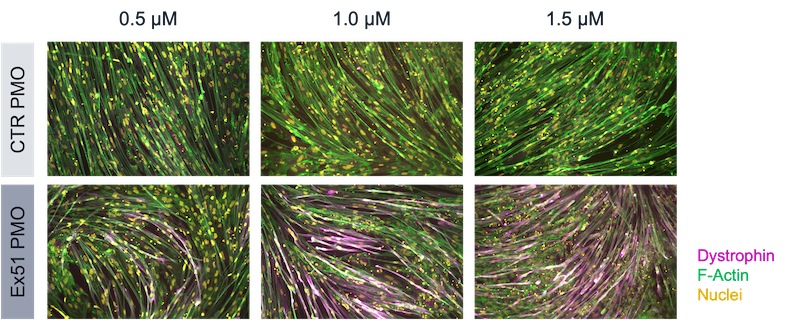 ASO-mediated dystrophin restoration in skeletal myocytes DMD exon 52 deletion model